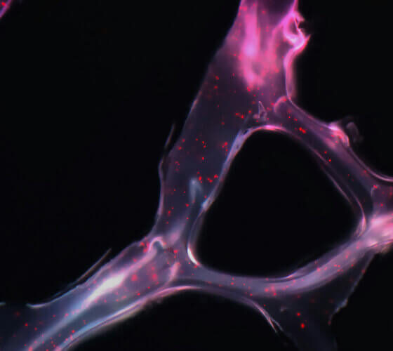 A visualisation of MRNA